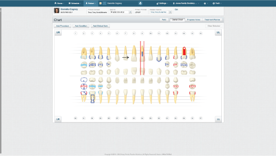 Dental Charting Practice Examples