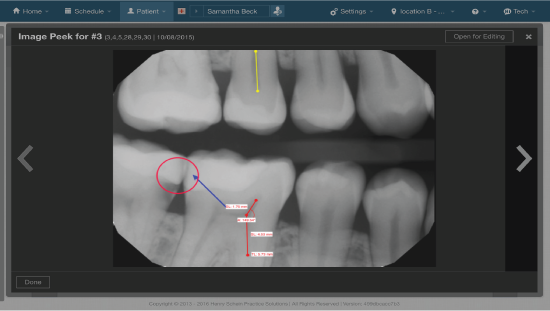 Dentrix Dental Charting